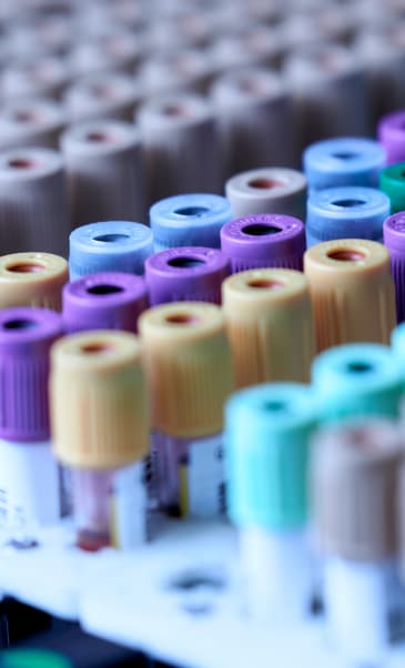 Sterilair Alergia ácaros: sintomase