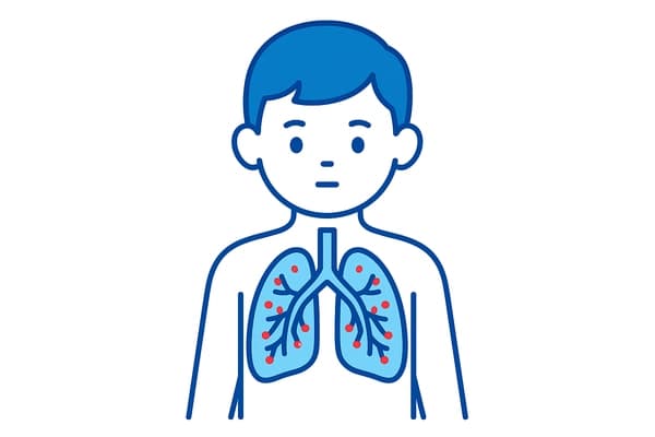 Bronquiolite em Criança
