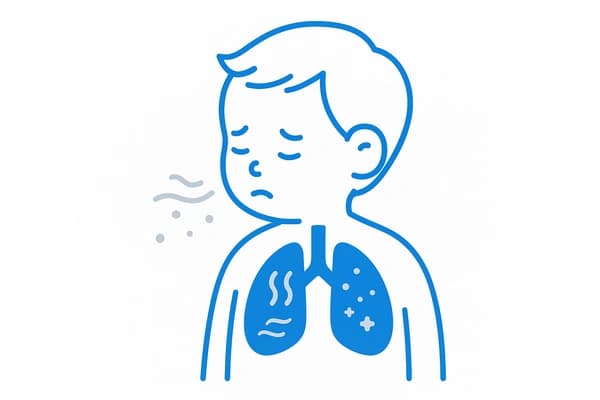 O que Causa Bronquiolite em Criança